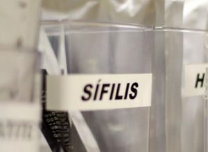 Centro-de-SP-tem-testagem-gratis-de-HIV-hepatite-siflis.jpeg