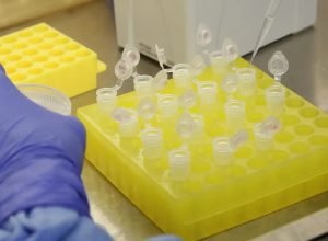 SP-confirma-segundo-caso-importado-de-sarampo.jpg