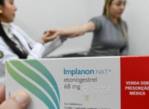 SUS-qualifica-profissionais-para-ampliar-oferta-de-implantes-hormonais.jpg