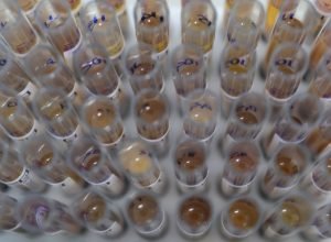 Uso-de-medicamento-oferecido-no-SUS-reduz-casos-de-malaria.jpg